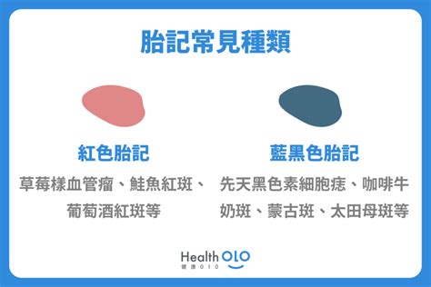 右小腿胎記|胎記怎麼產生、何時消除？醫師剖析胎記種類、胎記寓意